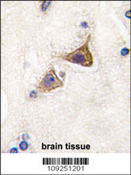 Junctophilin 3 Antibody (Center)
