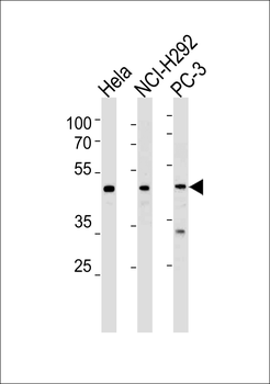 DAX1 (NR0B1) Antibody (N-term)