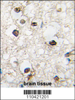QKI Antibody (N-term)