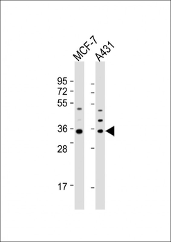 Cyclin D1 Antibody (S90)