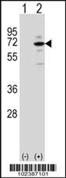 MeCP2 Antibody (N-term)
