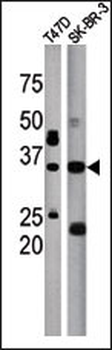 ICMT (C-term) Antibody