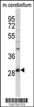 PPT1 Antibody (N-term)