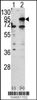 CPT1B Antibody (C-term)