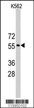 RNF36 (TRIM69) Antibody (Center H215)