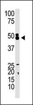 CBX8 Antibody (C-term)