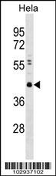 CBX8 Antibody (C-term)