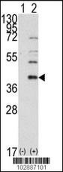 SAE1 (AOS1) Antibody (C-term)