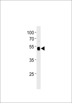 p53 Antibody (Sumoylation Site Specific)