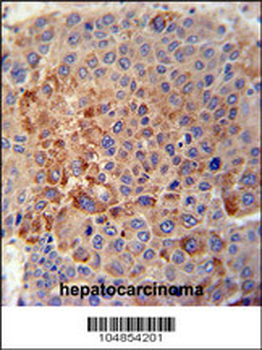 GPLD1 Antibody (C-term)
