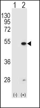 FDFT1 Antibody (N-term)