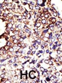 GCNT1 Antibody (Center)