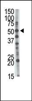 GCNT1 Antibody (Center)