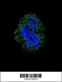 AGL Antibody (Center)