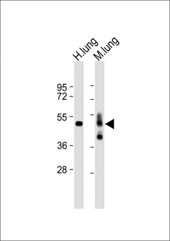 RAGE (AGER) Antibody (N-term)