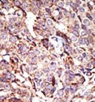 ARL6 Antibody (N-term)