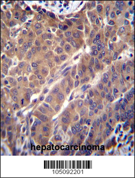ARL2 Antibody (C-term)