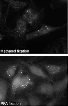 SQSTM1 (p62) Antibody (C-term)
