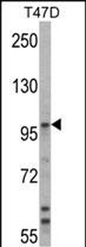 UBE3A Antibody (C-term)