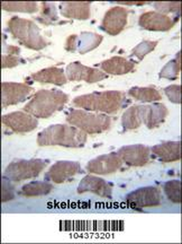 USP29 Antibody (Center)