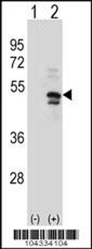 USP14 Antibody (N-term)