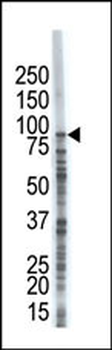 USP8 (UBPY) Antibody (C-term)
