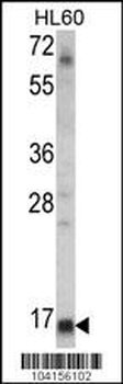 UBE2L6 Antibody (N-term)