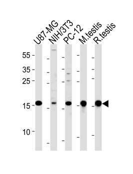 UBE2L3 Antibody (C-term)