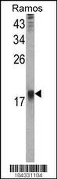 UBE2B Antibody (C-term)