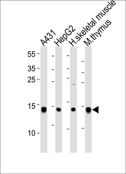 UBE2D1 Antibody (C-term)