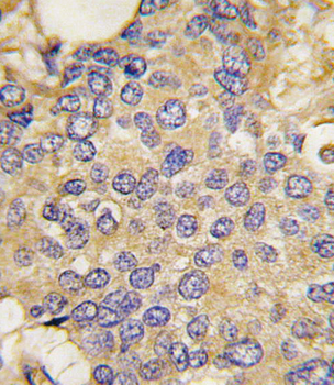 SMURF1 Antibody (N-term)