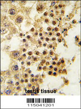 GDF3 Antibody (Center)