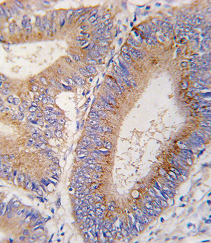 GDF11 Antibody (N-term)
