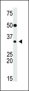 SLUG Antibody (Center)