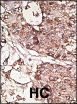 THY1 Antibody (N-term)
