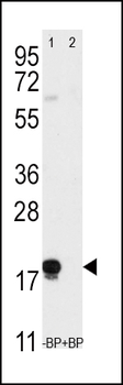 THY1 Antibody (N-term)