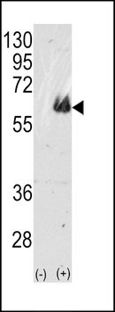 TAU Antibody (C-term)