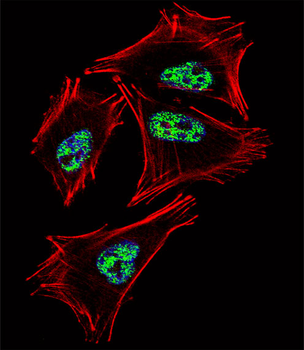 PROX1 Antibody (C-term)