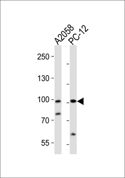 PROX1 Antibody (C-term)