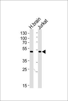 CHN1 Antibody (N-term)