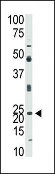 Neurogenin1 (NeuroG1) Antibody (N-term)