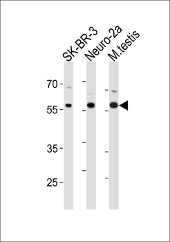 RELA Antibody (C-term S536)