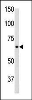 GFAP Antibody (C-term)
