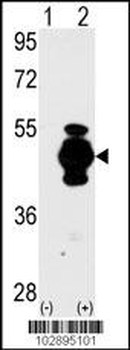 GFAP Antibody (N-term)
