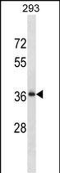 RALYL Antibody (N-term)