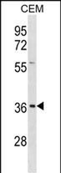 EFNB1 Antibody (Center)