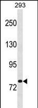 CHM Antibody (Center)
