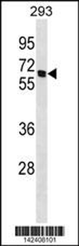 CHRNB4 Antibody (C-term)