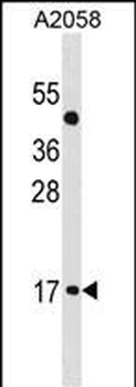 ATOH7 Antibody (Center)