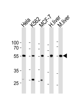 BMPR1A Antibody (N-term)